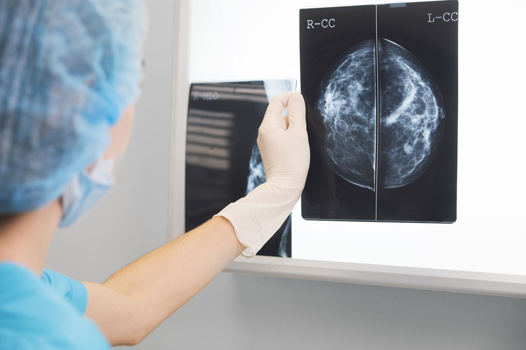 Radiologie-Eichsfeld-Mammografie-Auswertung-Heilbad-Heiligenstadt-13575869.jpg